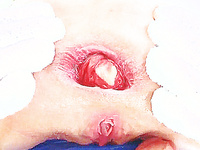 Asshole Gaping Photos Compilation