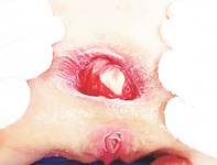 Beautiful Butthole gaping